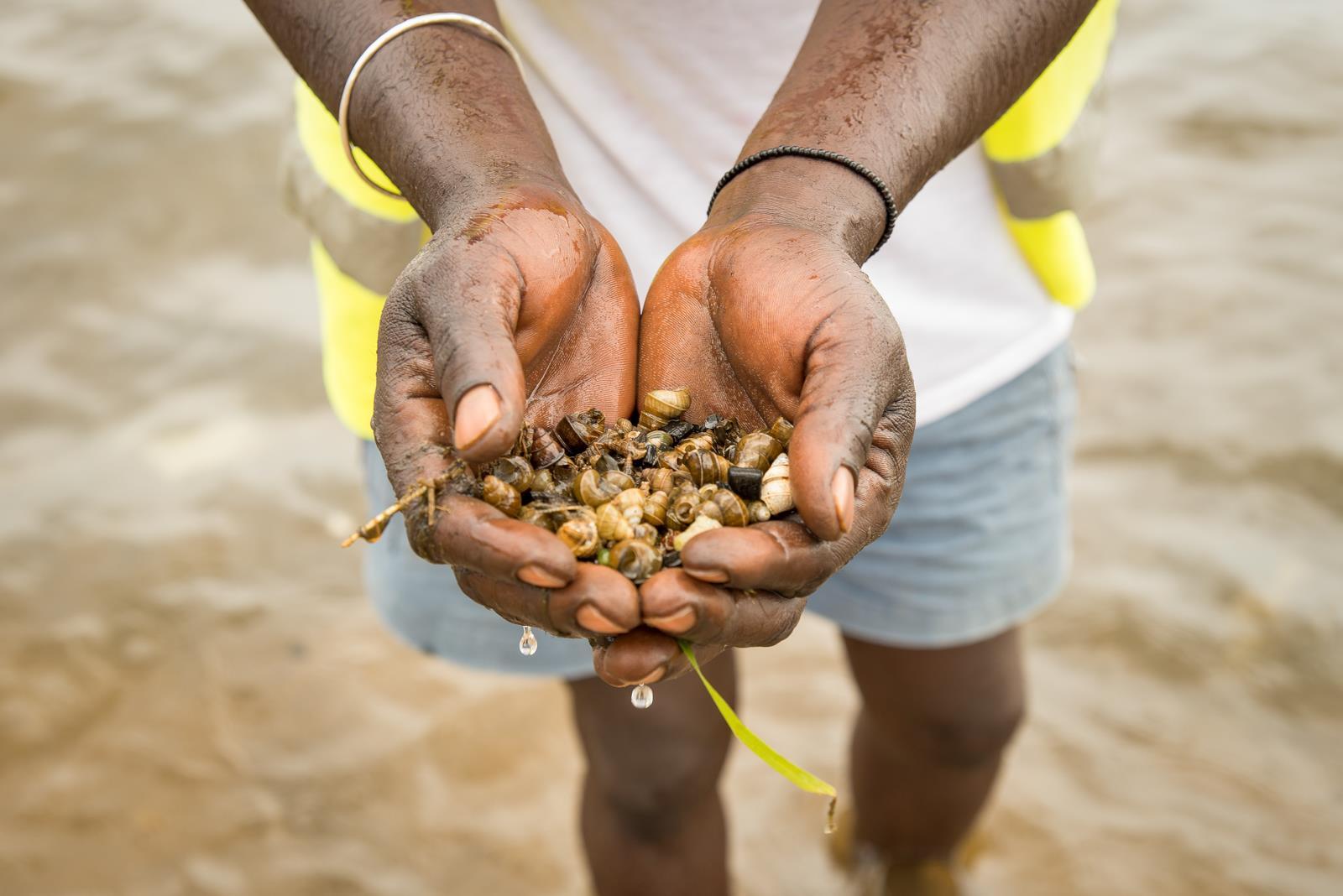 Concerted Efforts Needed to Eliminate Bilharzia in Africa